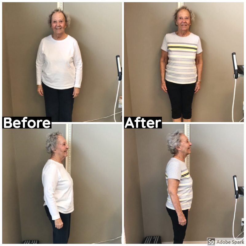 Client before and after photo